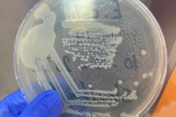 Biosorption of lead and cadmium from aqueous solutions by proteins extracted from E. coli cells